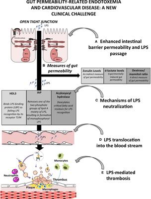 Editorial: Gut permeability-related endotoxemia and cardiovascular disease: A new clinical challenge